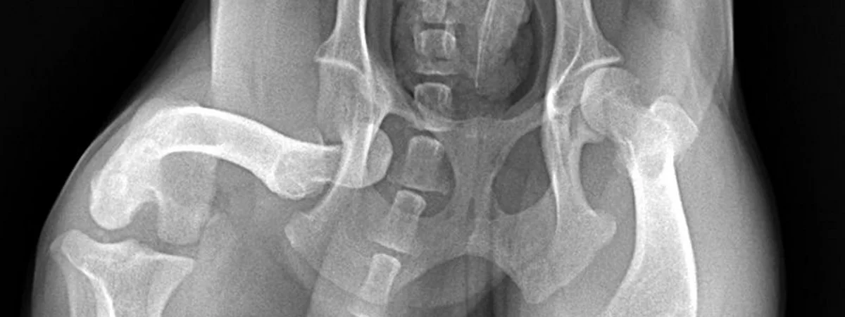 hip-luxation