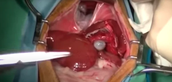 How to perform a diaphragmatic hernia repair in a cat