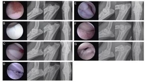 elbow dysplasia in dogs