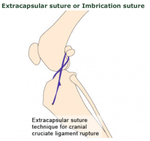 Treatment: Ligament Replacement
