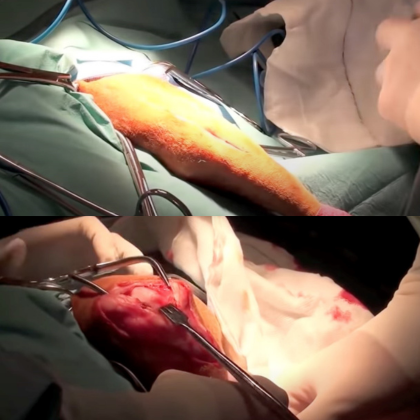 Extracapsular Repair For Dogs