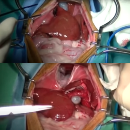 Diaphragmatic hernia in a cat