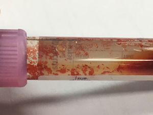 blood sample from a dog with IMHA